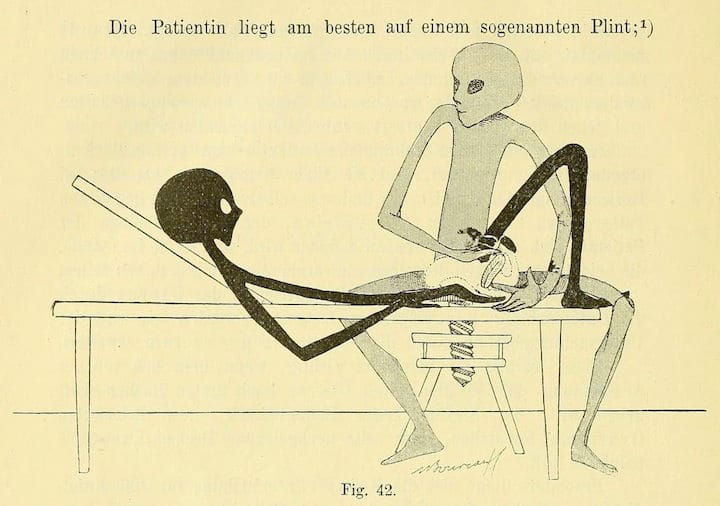 A black-colored gangly alien lies on an elevated examining table while a gray-colored alien sitting beside it performs a pelv