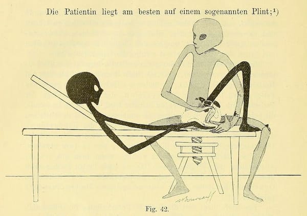 A black-colored gangly alien lies on an elevated examining table while a gray-colored alien sitting beside it performs a pelv